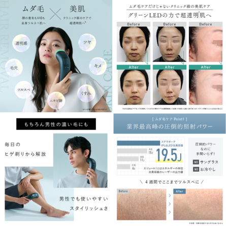 Kirala STELLA BEAUTE IPL&LED光美容器