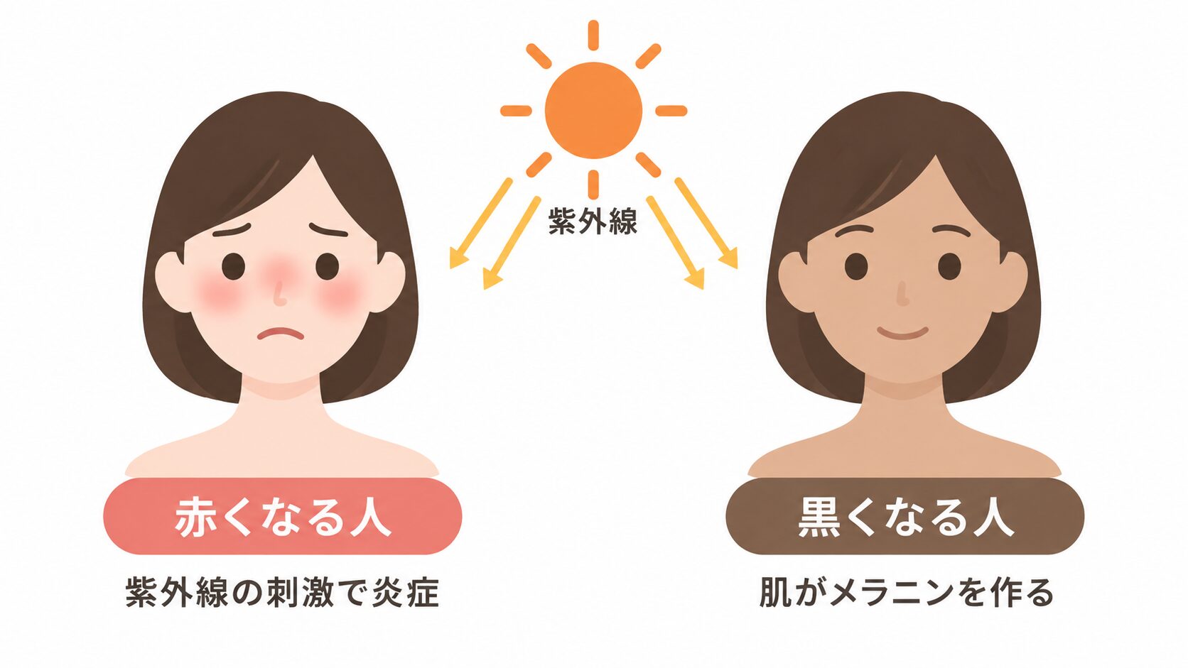 太陽から紫外線が降り注ぎ、頬が赤く困り顔の女性は「紫外線の刺激で炎症」、肌が日焼けして微笑む女性は「肌がメラニンを作る」と対比したイラスト。