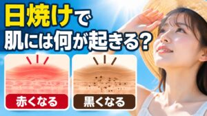 麦わら帽子の女性が青空の太陽を見上げ、「日焼けで肌には何が起きる?」の文字と、肌断面の「赤くなる」「黒くなる」2つの図が並ぶ。